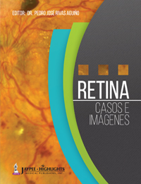 Retina Rivas 200x260